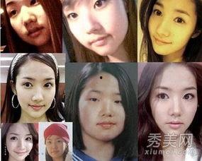 中国整容的明星有哪些,揭秘美丽背后的秘密