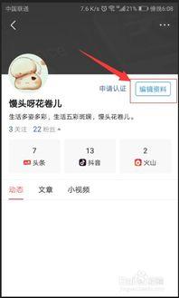在头条怎样修改名字,轻松修改名字，打造个性ID
